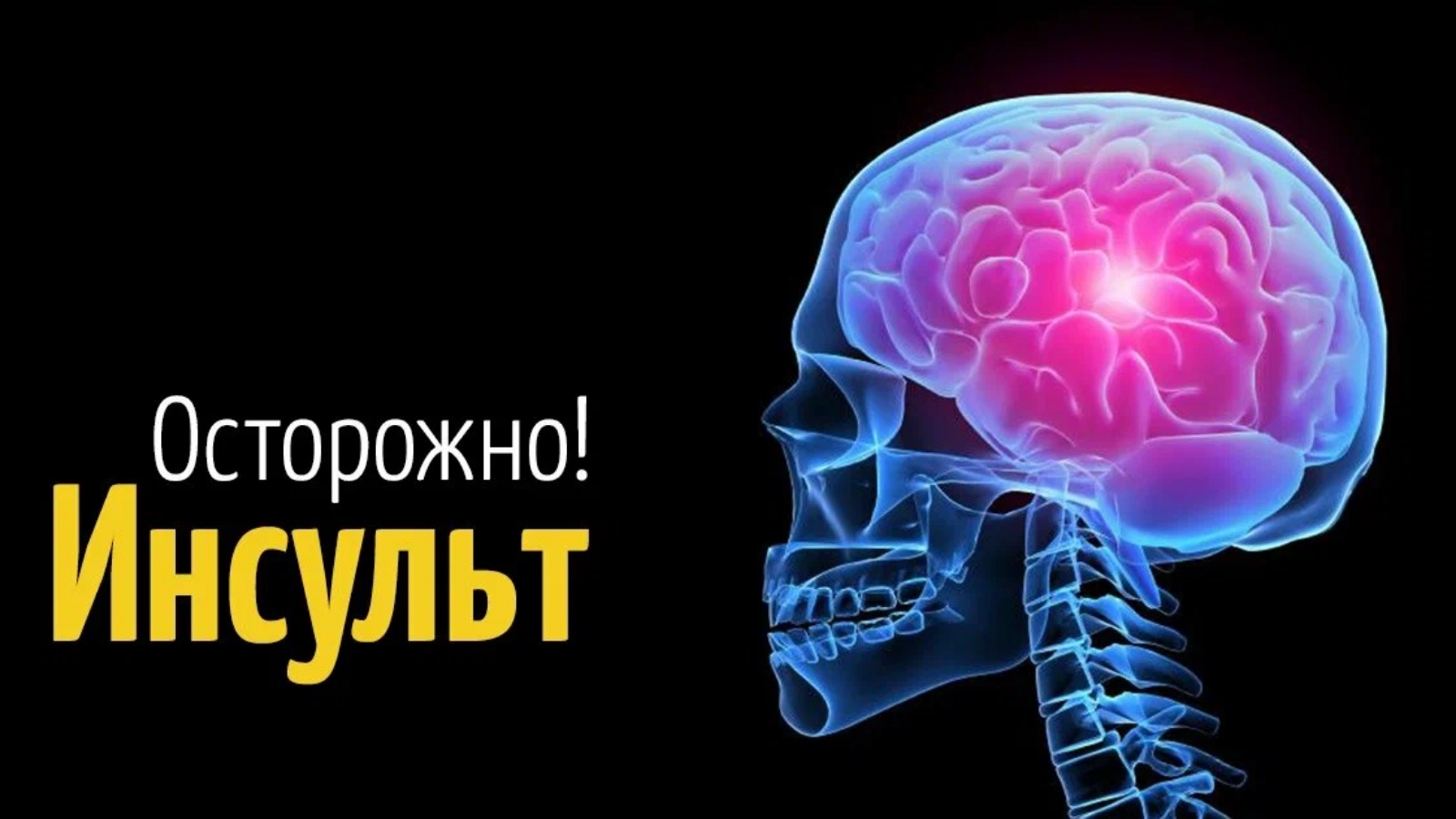 Инсульт видео. Инсульт. Инсульт картинки. Берегись инсульта. Инсульт рисунок.