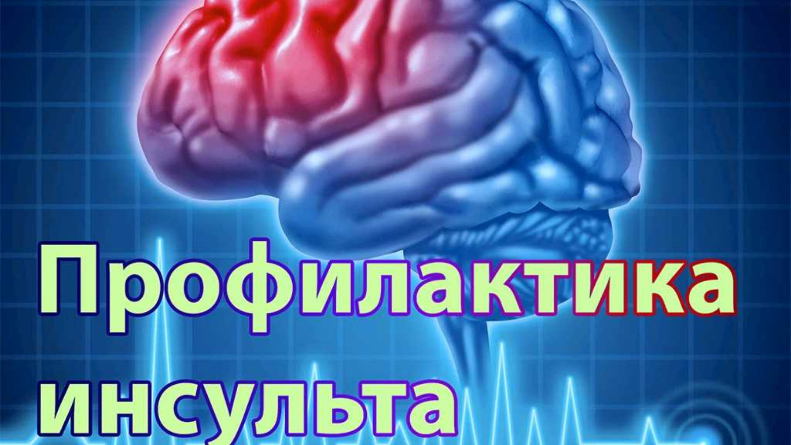 Профилактика инсульта - как избежать и какие средства | 27.10.2023 |  Аксубаево - БезФормата